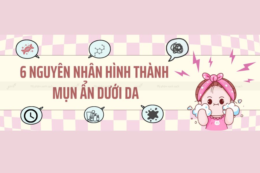 Sữa Rửa Mặt Cho Da Dầu Mụn Ẩn